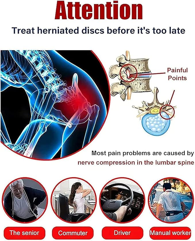 بخاخ جل بارد للعمود الفقري القطني من Supwell، منتجات لتخفيف آلام الظهر، وتخفيف آلام عرق النسا، وتخفيف آلام أسفل الظهر، وبخاخ لتخفيف آلام الرقبة والكتف والخصر والساقين والمفاصل (3 قطع)