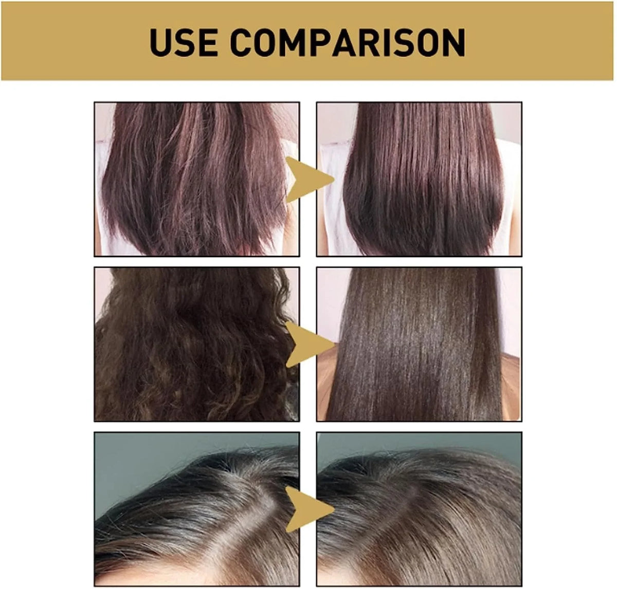 شامبو ساكورا الياباني لنمو الشعر ومنع التساقط ومكافحة القشرة 300 مل (Sakura Japanese Hair Growth & Anti-Dandruff Shampoo 300ml)
